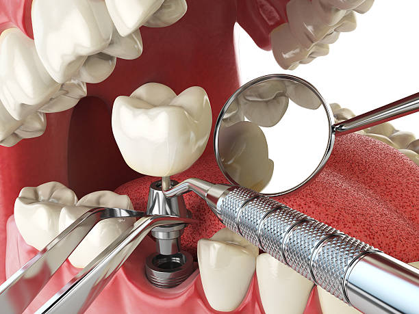 Best Root Canal Emergency Dentist  in Lexington Park, MD